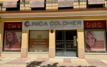 implantes dentales xativa